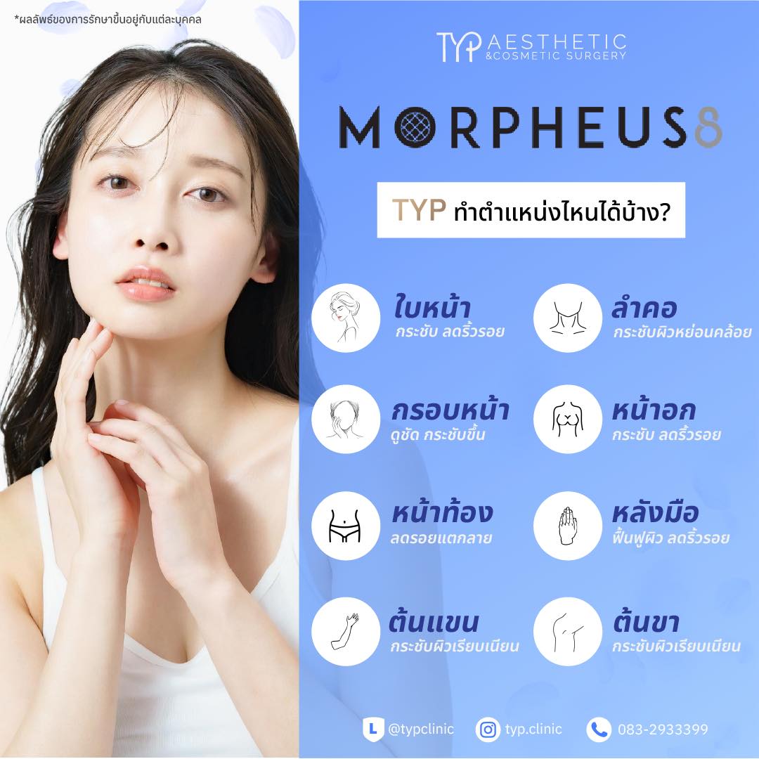 ข้อดี Morpheus 8 ทำตรงไหนได้บ้าง