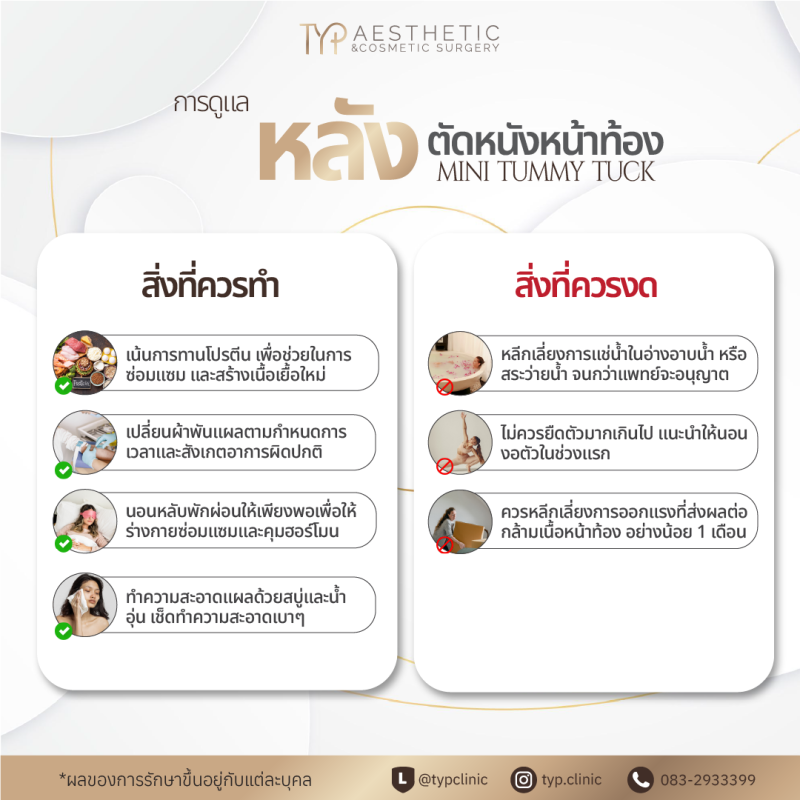 กสนดูแลรักษาหลังตัดหนังหน้าท้อง